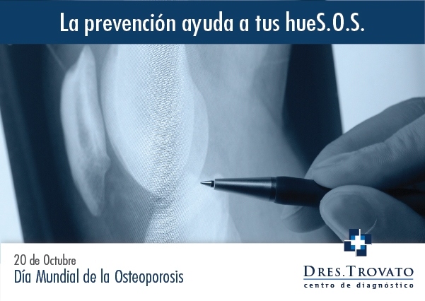 Día Mundial de la Osteoporosis